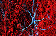光聲成像應(yīng)用-OPO激光器